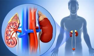 治疗尿毒症 治疗尿毒症